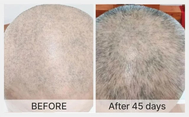 Visible reduction in gray hair